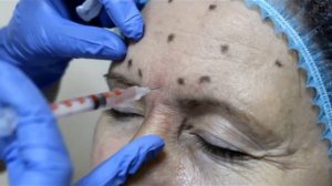 Салон «Райская птица», инъекции ботокса