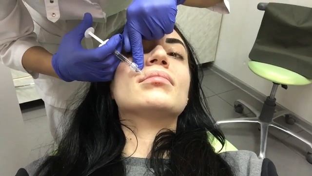 Губы, как жопа у обезьяны!!! смотреть онлайн