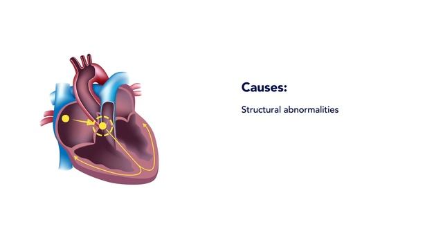 First Degree AV Block - EKG (ECG) Interpretation смотреть онлайн