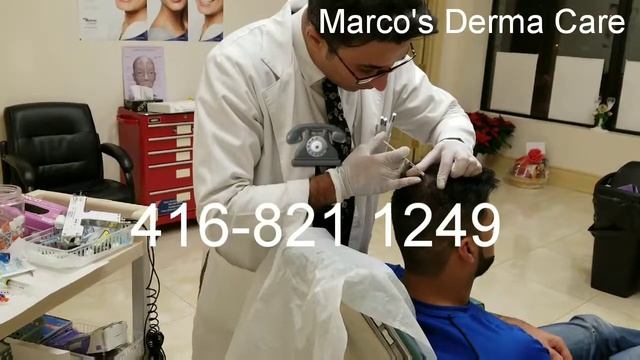 Hair restoration by PRP, Plasma, Marco's Derma Care, Hair empowerment, hair lost смотреть онлайн