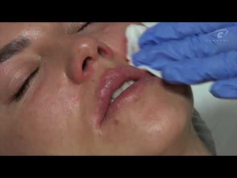 Как избежать эффекта 'клювика' смотреть онлайн