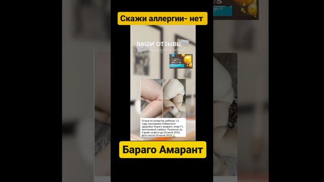 аллергия у ребенка смотреть онлайн