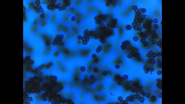 Lycoperdon Perlatum Spore Microscopy смотреть онлайн