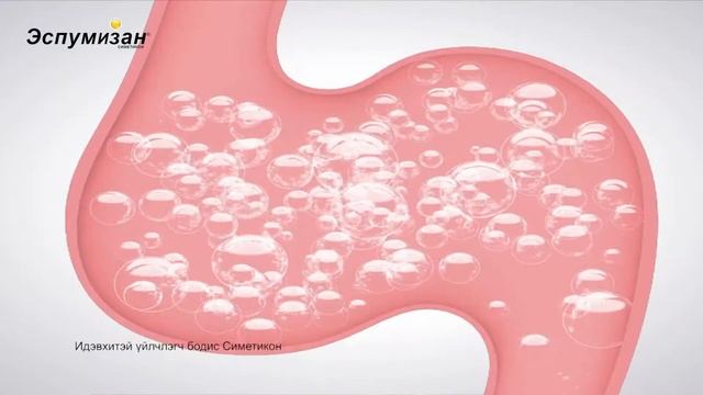 Espumisan - Эспумизан