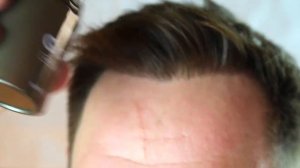 Маскировка облысения. Скрыть лысину. Редкие волосы