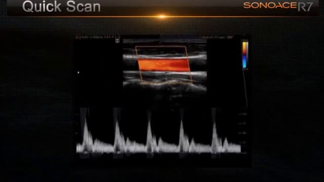 Samsung SonoAce R7 смотреть онлайн
