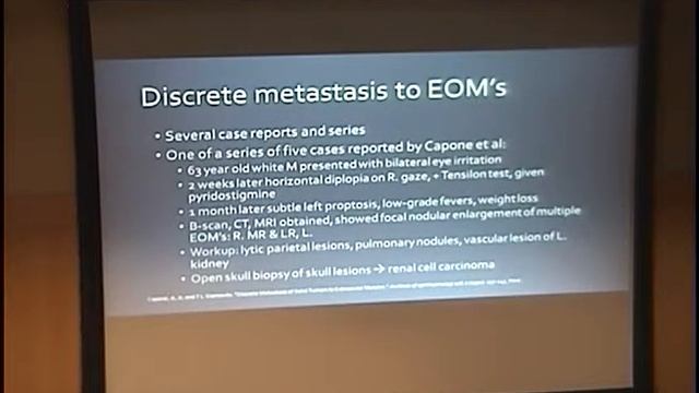 Lateral Rectus Mass in a 67 Year Old Male смотреть онлайн