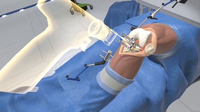 Let's Play Ghost Productions: Wraith VR Total Knee Replacement Surgery Simulation смотреть онлайн