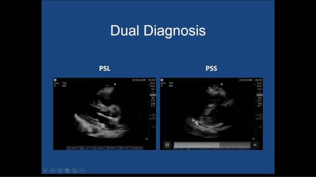 Critical Care Ultrasonography for Evaluation of Hemodynamic Failure смотреть онлайн