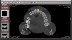 Radiant DICOM viewer для 3D. Знакомлюсь с программой.