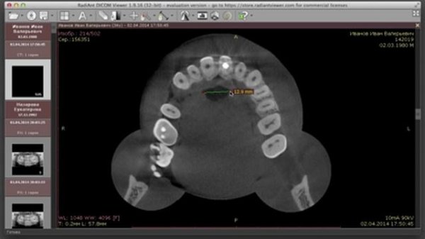 Radiant DICOM viewer для 3D. Знакомлюсь с программой.