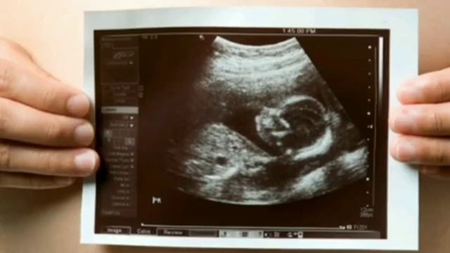 Скрининг Ваш доктор смотреть онлайн