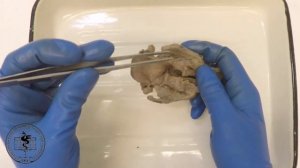 Спланхнология, анатомия гортани