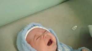 Массаж при дакриоцистите новорожденных