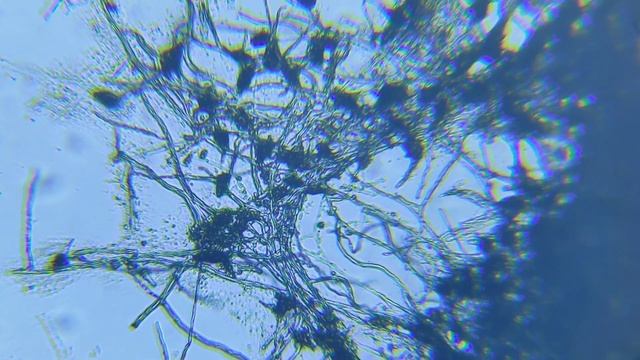 Черная плесень под микроскопом/Black mold смотреть онлайн