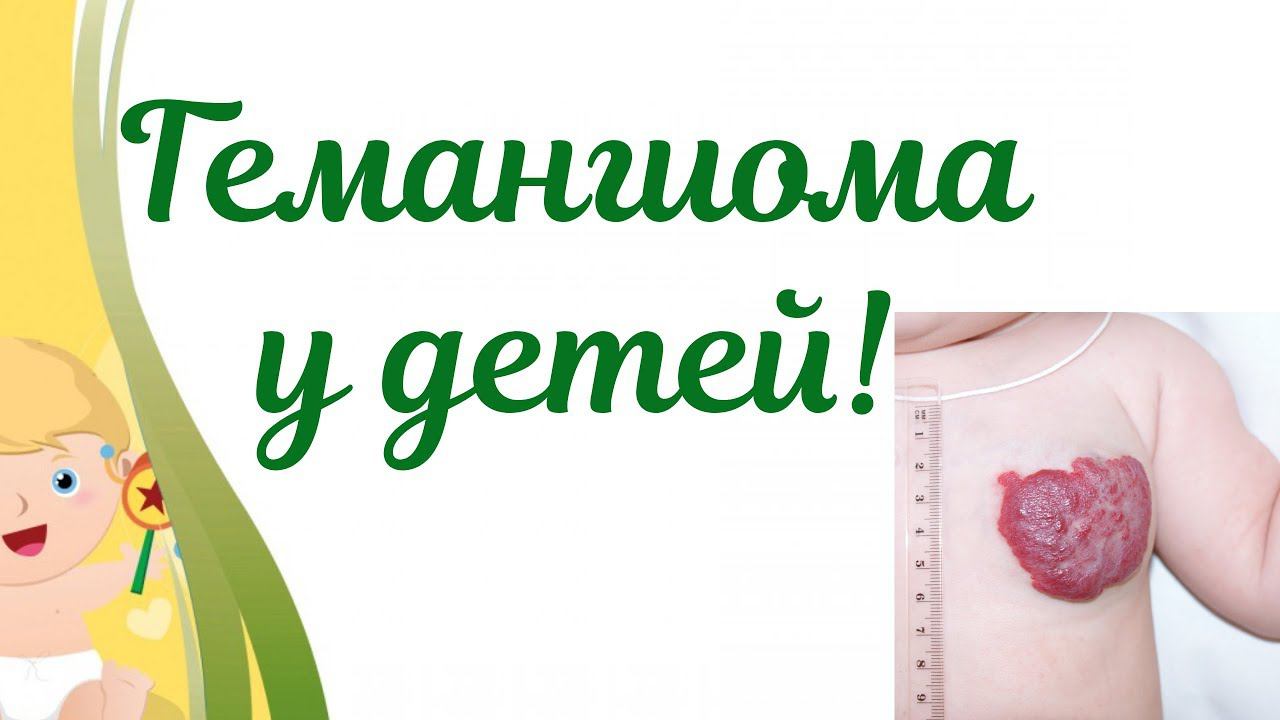Гемангиома у новорожденных.Действия мамы при гемангиоме! смотреть онлайн