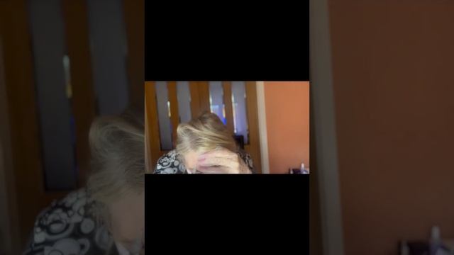 Exosome Facial Rejuvenation By Hanheal