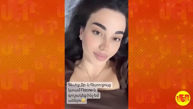 Կույր Աշխարհ 158 Kuyr Ashkhar 158 смотреть онлайн