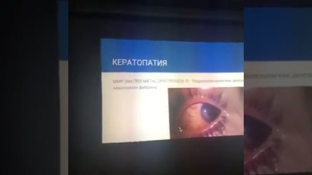 Аниридия. Доклад на межклиническом собрании врачей смотреть онлайн