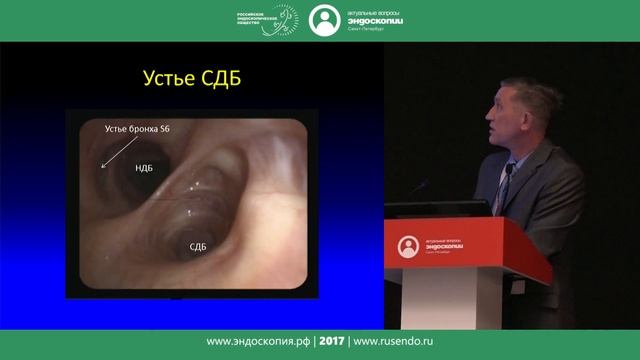 Анестезия и методика осмотра бронхиального дерева смотреть онлайн