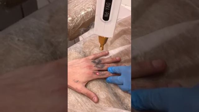 Вывожу наколки.?Сеанс 3/7 смотреть онлайн