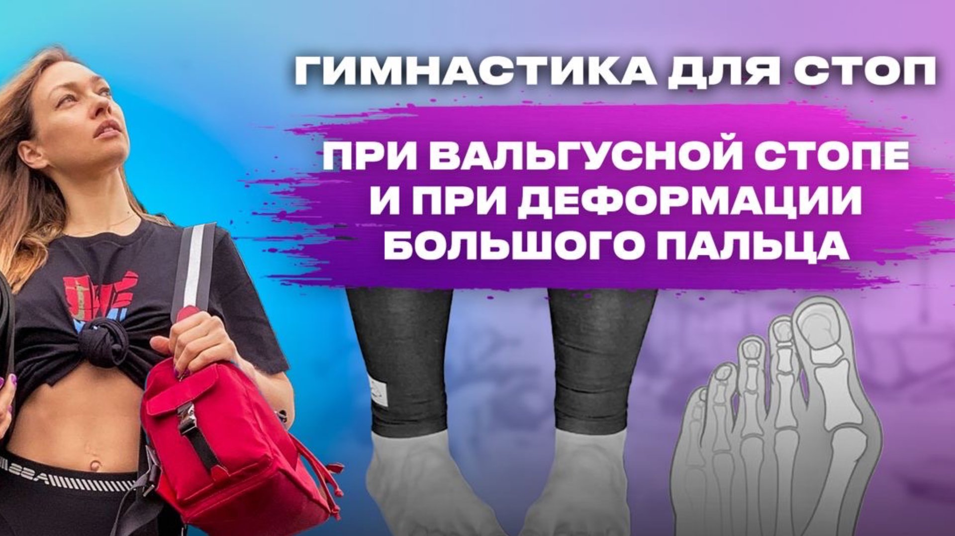 Исправляем Плоско-вальгустую установку стопы и халюс вальгус смотреть онлайн