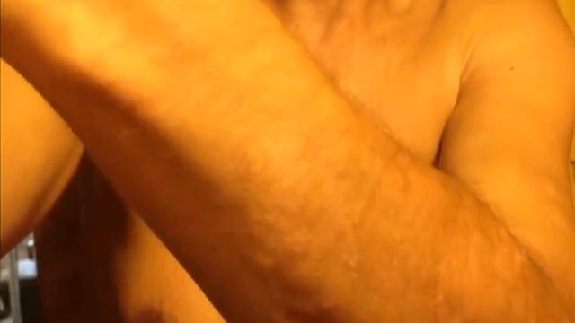 Часть 3. Псориаз это не болезнь. Минимальное проявление псориаза. смотреть онлайн