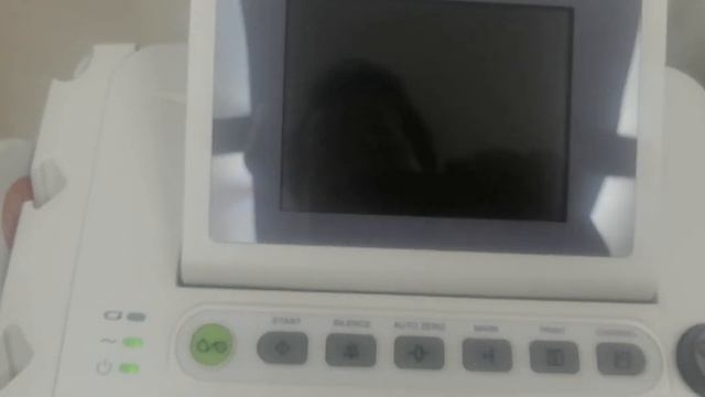 How to connect Edan F3 ctg machine to Central Monitoring system. смотреть онлайн