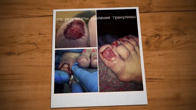 Елена Дзык. Реальные отзывы пострадавших смотреть онлайн