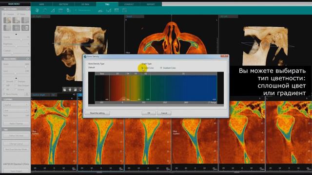 Плотность костной ткани; изменение макета смотреть онлайн