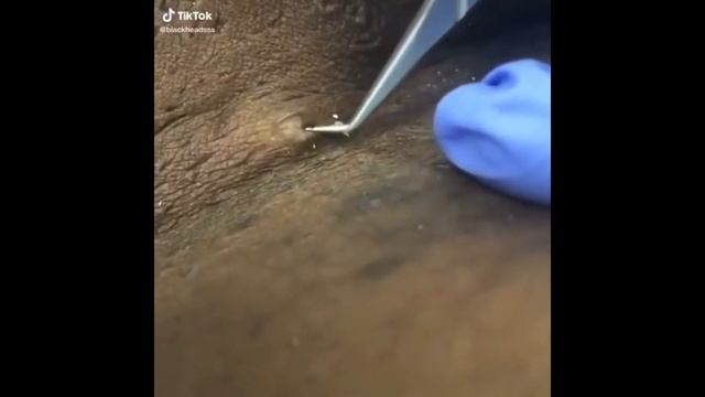 Вросший волосы/Relax Every Day ?Самое залипательное видео