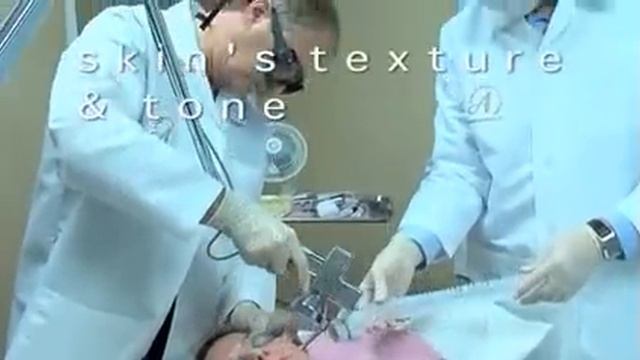 Лазерные шлифовки смотреть онлайн