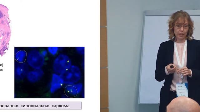 Патоморфологическая картина костных и мягкотканных сарком. Шелехова К.В. (Санкт-Петербург) смотреть онлайн