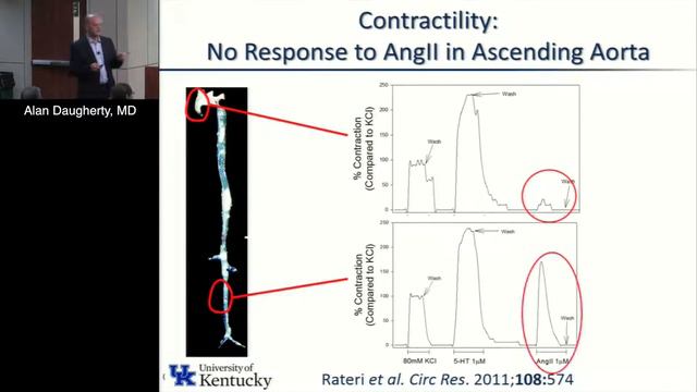 Complex Developmental Origins of the Thoracic Aorta (Alan Daugherty, MD) 03/30/17 смотреть онлайн