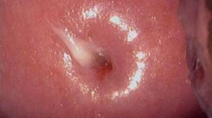 Строение шейки матки