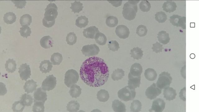 лейкоформула смотреть онлайн