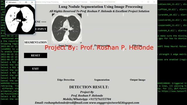 Lung Nodule Segmentation Using Image Processing | With Source Code Python Tensorflow OpenCv Project смотреть онлайн
