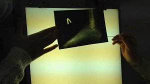 Рентген стопы и голеностопного сустава