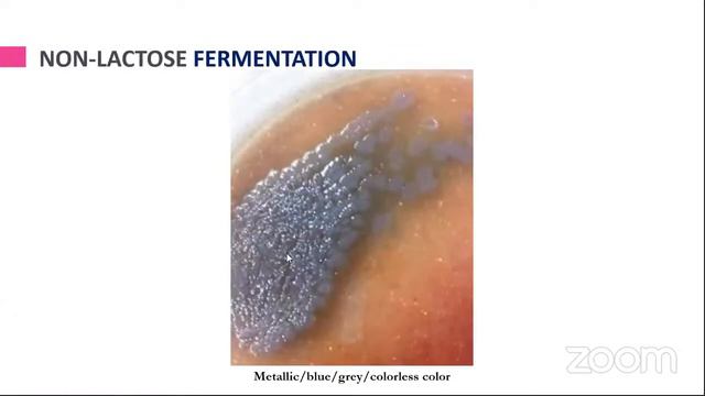 Review of Microbiology and Antibiotics (1) смотреть онлайн