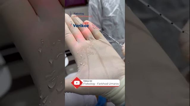 НОВАЦИЯ В СФЕРЕ ФЛЕБОЛОГИИ В УЗБЕКИСТАНЕ смотреть онлайн