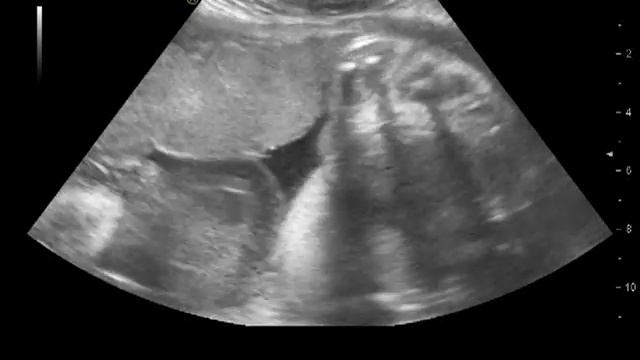 D25 Мозг плода смотреть онлайн