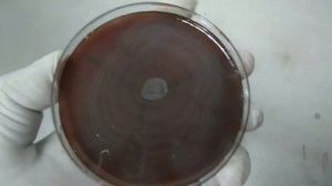 Proteus Swarming growth and its reason occuring so