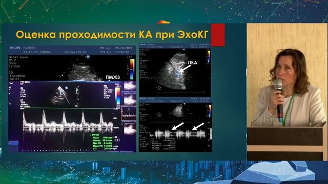 48 Мультимодальная диагностика хронической ишемической болезни сердца Мороз Водолажская Наталья смотреть онлайн