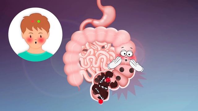 Firmin l'intestin смотреть онлайн