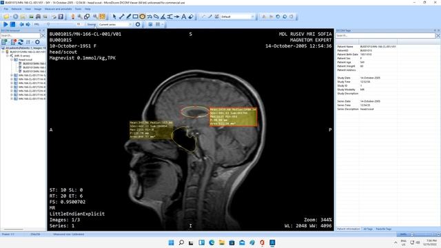 How to copy a DICOM image to clipboard? смотреть онлайн