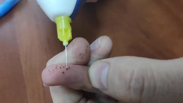Сравнение Pelsar и Plasma Pen смотреть онлайн