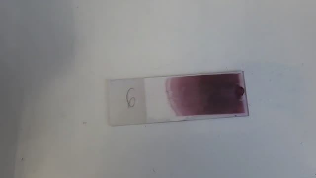 Подсчёт лейкоцитарной формулы с нуля смотреть онлайн