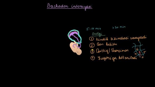 Bachadon Inversiyasi | Homiladorlik Va Homiladorlik Asoratlari | Tibbiyot