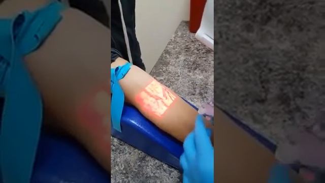 Перед тем как сделать укол, нужно найти вену смотреть онлайн