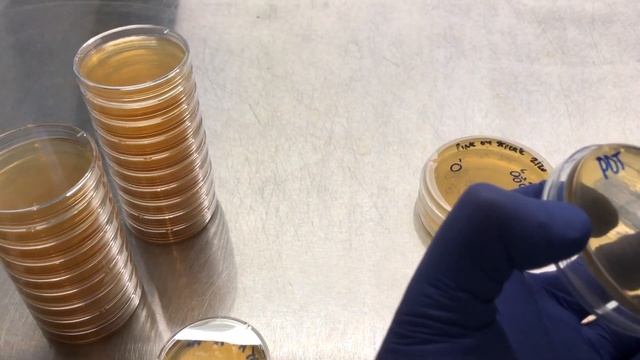 Breeding Project day 6 Transferring Isolate Colonies смотреть онлайн